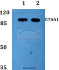 Western blot (WB) analysis of ETAA1 polyclonal antibody at 1:500 dilution
Lane1:MCF-7 whole cell lysate
Lane2:PC12 whole cell lysate