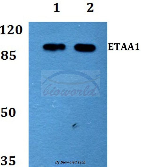 Western blot (WB) analysis of ETAA1 polyclonal antibody at 1:500 dilution
Lane1:MCF-7 whole cell lysate
Lane2:PC12 whole cell lysate