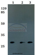 Western blot (WB) analysis of FOLR3 polyclonal antibody at 1:500 dilution
Lane1:MCF-7 whole cell lysate
Lane2:sp2/0 whole cell lysate
Lane3:Rat brain tissue lysate