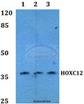 Western blot (WB) analysis of HOX-C12 polyclonal antibody at 1:500 dilution
Lane1:MCF-7 whole cell lysate
Lane2:NIH-3T3 whole cell lysate
Lane3:PC12 whole cell lysate