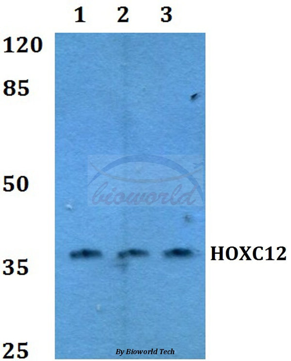 Western blot (WB) analysis of HOX-C12 polyclonal antibody at 1:500 dilution
Lane1:MCF-7 whole cell lysate
Lane2:NIH-3T3 whole cell lysate
Lane3:PC12 whole cell lysate