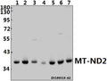 Western blot (WB) analysis of MT-ND2 pAb at 1:1000 dilution
Lane1:LOVO whole cell lysate(30ug)
Lane2:L02 whole cell lysate(30ug)
Lane3:The Heart tissue lysate of Mouse(40ug)
Lane4:The Kidney tissue lysate of Rat(40ug)
Lane5:H9C2 whole cell lysate(40ug)
Lane6:CT26 whole cell lysate(40ug)
Lane7:SGC7901 whole cell lysate(40ug)