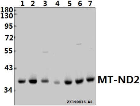 Western blot (WB) analysis of MT-ND2 pAb at 1:1000 dilution
Lane1:LOVO whole cell lysate(30ug)
Lane2:L02 whole cell lysate(30ug)
Lane3:The Heart tissue lysate of Mouse(40ug)
Lane4:The Kidney tissue lysate of Rat(40ug)
Lane5:H9C2 whole cell lysate(40ug)
Lane6:CT26 whole cell lysate(40ug)
Lane7:SGC7901 whole cell lysate(40ug)