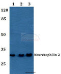 Western blot (WB) analysis of Neurexophilin-2 polyclonal antibody at 1:500 dilution
Lane1:HEK293T whole cell lysate
Lane2:Mouse brain tissue lysate
Lane3:Rat brain tissue lysate