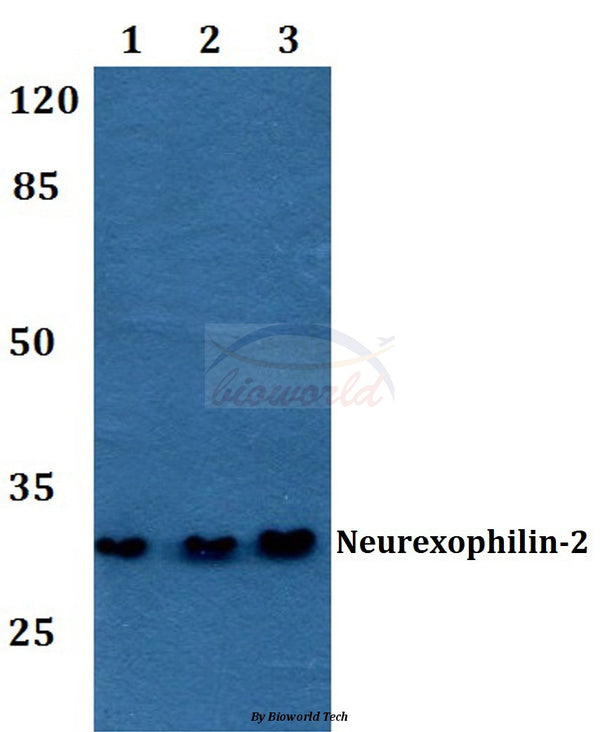 Western blot (WB) analysis of Neurexophilin-2 polyclonal antibody at 1:500 dilution
Lane1:HEK293T whole cell lysate
Lane2:Mouse brain tissue lysate
Lane3:Rat brain tissue lysate