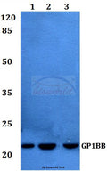 Western blot (WB) analysis of GP1BB polyclonal antibody at 1:500 dilution
Lane1:Jurkat whole cell lysate
Lane2:sp2/0 whole cell lysate
Lane3:Rat heart tissue lysate
