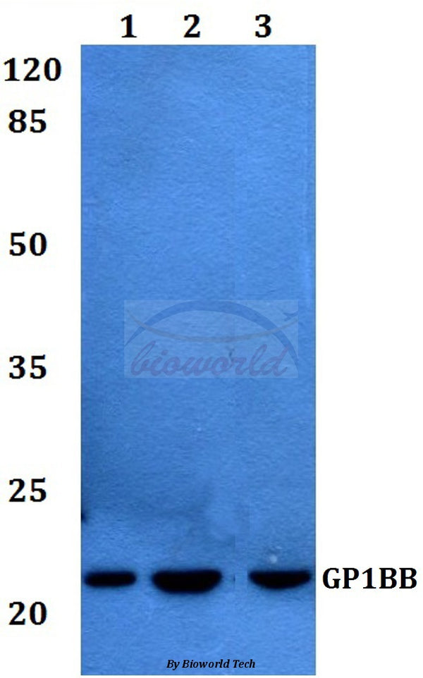 Western blot (WB) analysis of GP1BB polyclonal antibody at 1:500 dilution
Lane1:Jurkat whole cell lysate
Lane2:sp2/0 whole cell lysate
Lane3:Rat heart tissue lysate