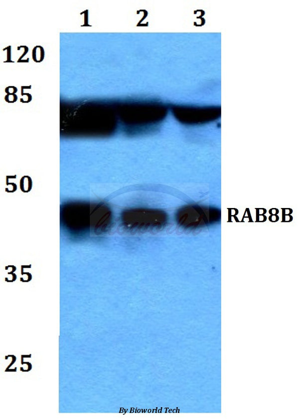 Western blot (WB) analysis of RAB8B polyclonal antibody at 1:500 dilution
Lane1:HEK293T whole cell lysate
Lane2:sp2/0 whole cell lysate
Lane3:PC12 whole cell lysate