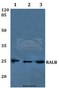 Western blot (WB) analysis of RALB polyclonal antibody at 1:500 dilution
Lane1:A549 whole cell lysate
Lane2:NIH-3T3 whole cell lysate
Lane3:PC12 whole cell lysate