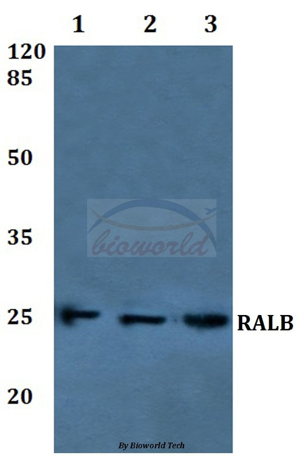 Western blot (WB) analysis of RALB polyclonal antibody at 1:500 dilution
Lane1:A549 whole cell lysate
Lane2:NIH-3T3 whole cell lysate
Lane3:PC12 whole cell lysate