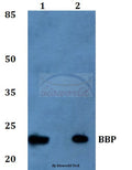 Western blot (WB) analysis of BBP polyclonal antibody at 1:500 dilution
Lane1:MCF-7 whole cell lysate
Lane2:Mouse kidney tissue lysate