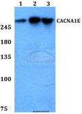 Western blot (WB) analysis of CACNA1E polyclonal antibody at 1:500 dilution
Lane1:HEK293T whole cell lysate
Lane2:Raw264.7 whole cell lysate
Lane3:PC12 whole cell lysate