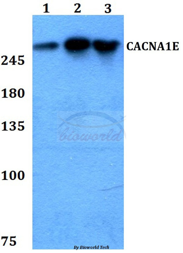 Western blot (WB) analysis of CACNA1E polyclonal antibody at 1:500 dilution
Lane1:HEK293T whole cell lysate
Lane2:Raw264.7 whole cell lysate
Lane3:PC12 whole cell lysate