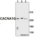 Western blot (WB) analysis of CACNA1G pAb at 1:500 dilution
Lane1:Myla2059 whole cell lysate(40ug)
Lane2:Hela whole cell lysate(40ug)
Lane3:A549 whole cell lysate(40ug)