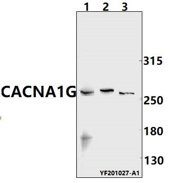 Western blot (WB) analysis of CACNA1G pAb at 1:500 dilution
Lane1:Myla2059 whole cell lysate(40ug)
Lane2:Hela whole cell lysate(40ug)
Lane3:A549 whole cell lysate(40ug)