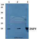 Western blot (WB) analysis of ZNF9 polyclonal antibody at 1:500 dilution
Lane1:MCF-7 cell lysate
Lane2:Raw264.7 cell lysate
Lane3:Mouse brain tissue lysate
