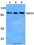 Western blot (WB) analysis of ZNF25 polyclonal antibody at 1:500 dilution
Lane1:Hela whole cell lysate
Lane2:NIH-3T3 whole cell lysate
Lane3:H9C2 whole cell lysate