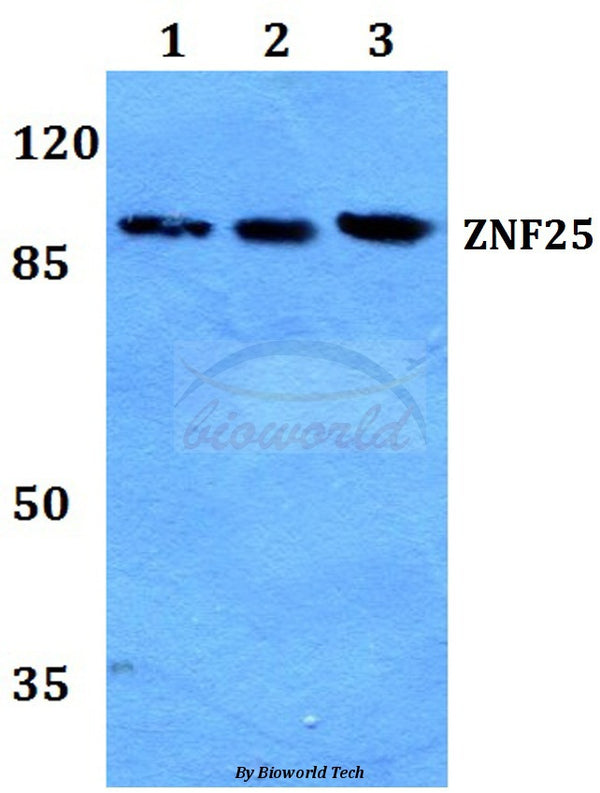 Western blot (WB) analysis of ZNF25 polyclonal antibody at 1:500 dilution
Lane1:Hela whole cell lysate
Lane2:NIH-3T3 whole cell lysate
Lane3:H9C2 whole cell lysate
