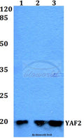 Western blot (WB) analysis of YAF2 polyclonal antibody at 1:500 dilution
Lane1:Jurkat whole cell lysate
Lane2:Raw264.7 whole cell lysate
Lane3:H9C2 whole cell lysate