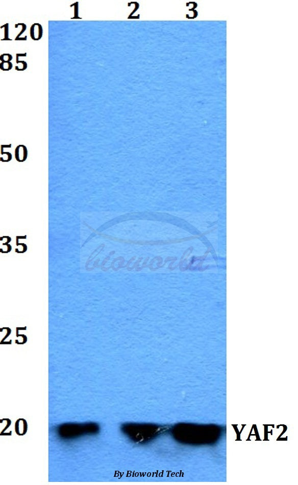 Western blot (WB) analysis of YAF2 polyclonal antibody at 1:500 dilution
Lane1:Jurkat whole cell lysate
Lane2:Raw264.7 whole cell lysate
Lane3:H9C2 whole cell lysate