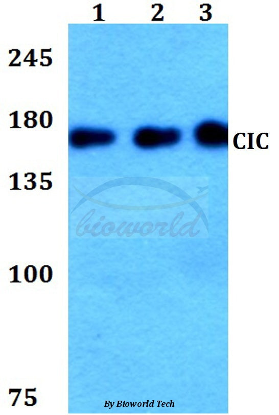 Western blot (WB) analysis of CIC polyclonal antibody at 1:500 dilution
Lane1:HEK293T whole cell lysate
Lane2:Raw264.7 whole cell lysate
Lane3:PC12 whole cell lysate