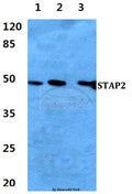 Western blot (WB) analysis of STAP2 polyclonal antibody at 1:500 dilution
Lane1:HEK293T cell lysate 
Lane2:sp2/0 cell lysate
Lane3:PC12 cell lysate