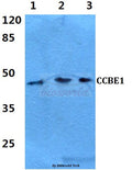 Western blot (WB) analysis of CCBE1 polyclonal antibody at 1:500 dilution
Lane1:Hela cell lysate 
Lane2:sp2/0 cell lysate
Lane3:PC12 cell lysate