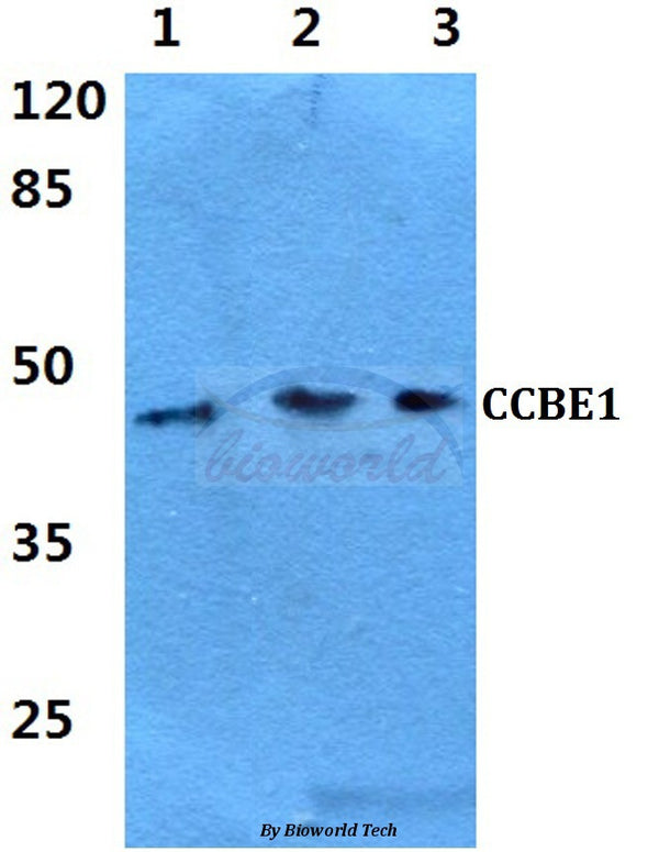 Western blot (WB) analysis of CCBE1 polyclonal antibody at 1:500 dilution
Lane1:Hela cell lysate 
Lane2:sp2/0 cell lysate
Lane3:PC12 cell lysate