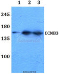 Western blot analysis of Cyclin B3 expression in rat brain (A), 
mouse liver (B) whole cell lysates.