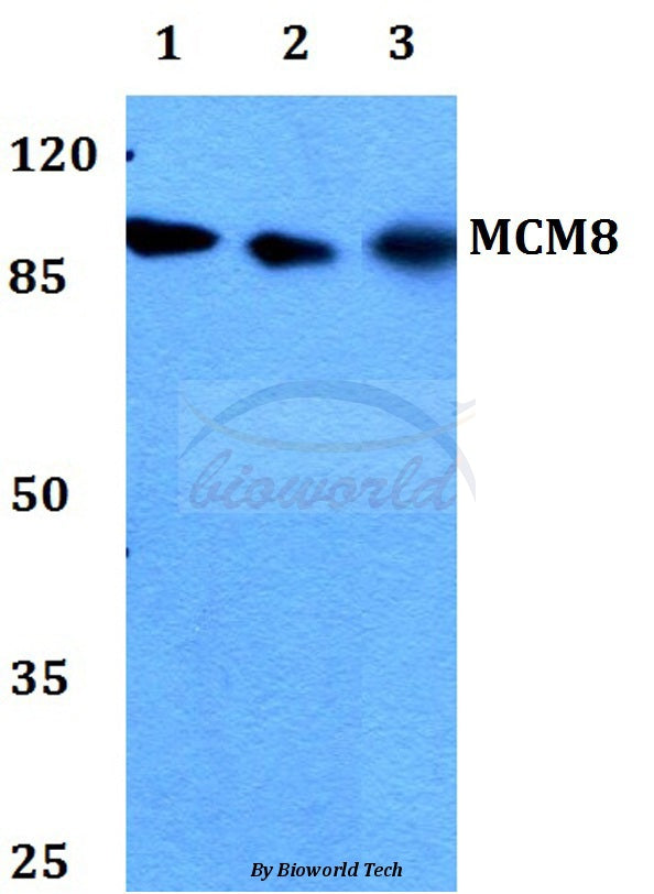 Western blot (WB) analysis of MCM8 polyclonal antibody at 1:500 dilution
Lane1:HEK293T whole cell lysate
Lane2:Raw264.7 whole cell lysate
Lane3:H9C2 whole cell lysate