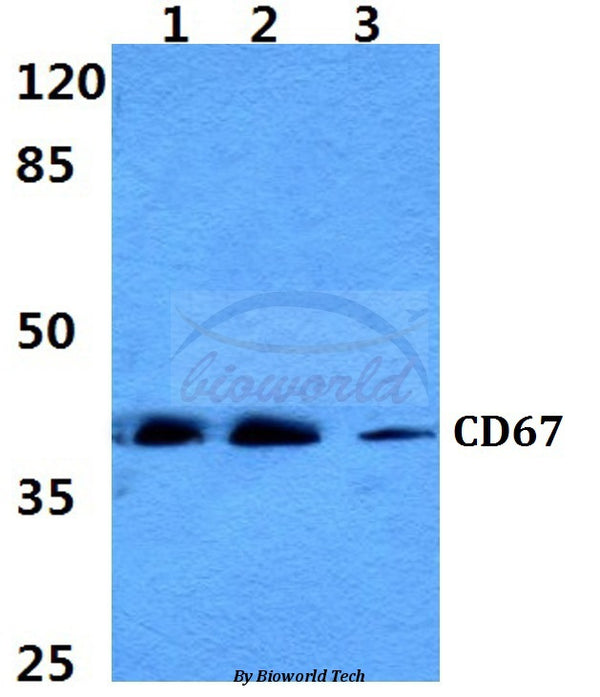 Western blot (WB) analysis of CD67 polyclonal antibody at 1:500 dilution
Lane1:MCF-7 cell lysate
Lane2:NIH-3T3 cell lysate
Lane3:PC12 cell lysate