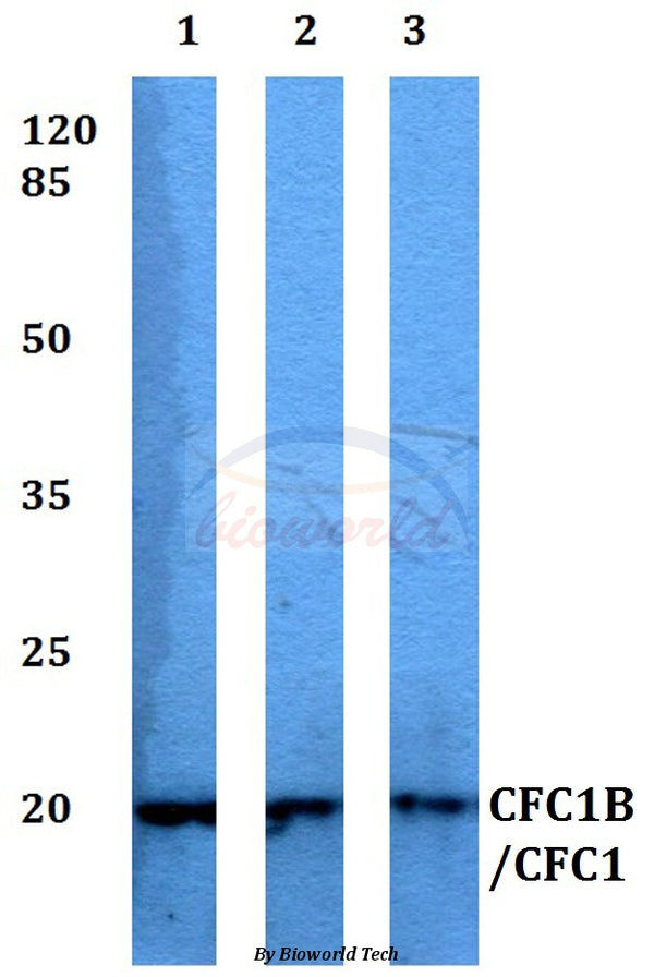 Western blot (WB) analysis of CFC1B/CFC1 polyclonal antibody at 1:500 dilution
Lane1:HEK293T whole cell lysate
Lane2:Raw264.7 whole cell lysate
Lane3:H9C2 whole cell lysate
