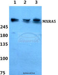 Western blot (WB) analysis of MXRA5 polyclonal antibody at 1:500 dilution
Lane1:Hela cell lysate
Lane2:sp2/0 cell lysate
Lane3:PC12 cell lysate