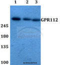 Western blot (WB) analysis of GPR112 polyclonal antibody at 1:500 dilution
Lane1:A549 whole cell lysate
Lane2:Raw264.7 whole cell lysate
Lane3:H9C2 whole cell lysate