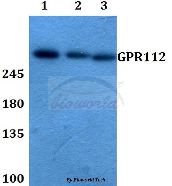 Western blot (WB) analysis of GPR112 polyclonal antibody at 1:500 dilution
Lane1:A549 whole cell lysate
Lane2:Raw264.7 whole cell lysate
Lane3:H9C2 whole cell lysate