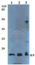 Western blot (WB) analysis of IL9 polyclonal antibody at 1:500 dilution
Lane1:HEK293T whole cell lysate
Lane2:Mouse heart tissue lysate
Lane3:Rat heart tissue lysate
