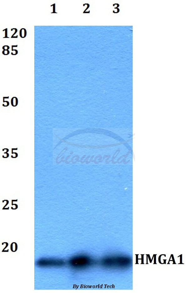 HMGA1 polyclonal antibody – Figure 1 of 1