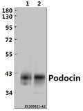 Western blot (WB) analysis of Podocin pAb at 1:1000 dilution
Lane1:The Kidney tissue lysate of Mouse(20ug)                                                                                                                   
Lane2:The Kidney tissue lysate of Rat(30ug)