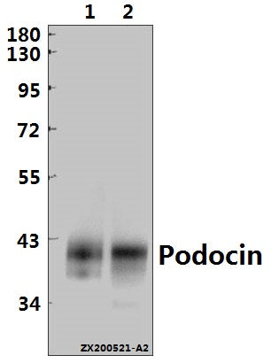 Western blot (WB) analysis of Podocin pAb at 1:1000 dilution
Lane1:The Kidney tissue lysate of Mouse(20ug)                                                                                                                   
Lane2:The Kidney tissue lysate of Rat(30ug)