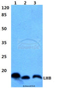 LHB polyclonal antibody – Figure 1 of 1