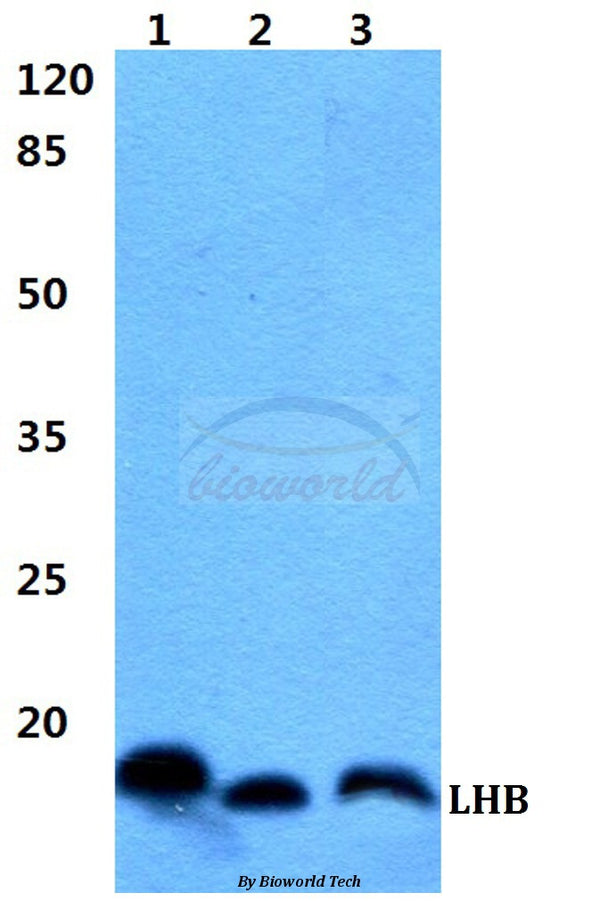 LHB polyclonal antibody – Figure 1 of 1