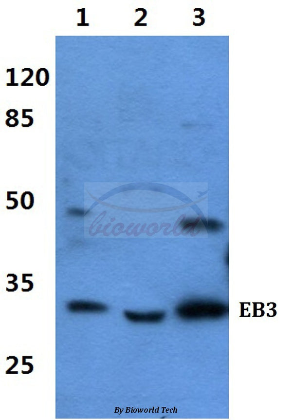 EB3 polyclonal antibody – Figure 1 of 1