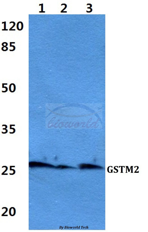 Western blot (WB) analysis of GSTM2 polyclonal antibody at 1:500 dilution
Lane1:Hela cell lysate
Lane2:Mouse liver tissue lysate
Lane3:Rat liver tissue lysate