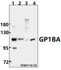 Western blot (WB) analysis of GP1BA pAb at 1:500 dilution
Lane1:Myla2059 whole cell lysate(40ug)
Lane2:SHSY5Y whole cell lysate(40ug) 
Lane3:SP2/0 whole cell lysate(40ug)
Lane4:C6 whole cell lysate(40ug)