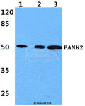 PANK2 polyclonal antibody – Figure 1 of 1