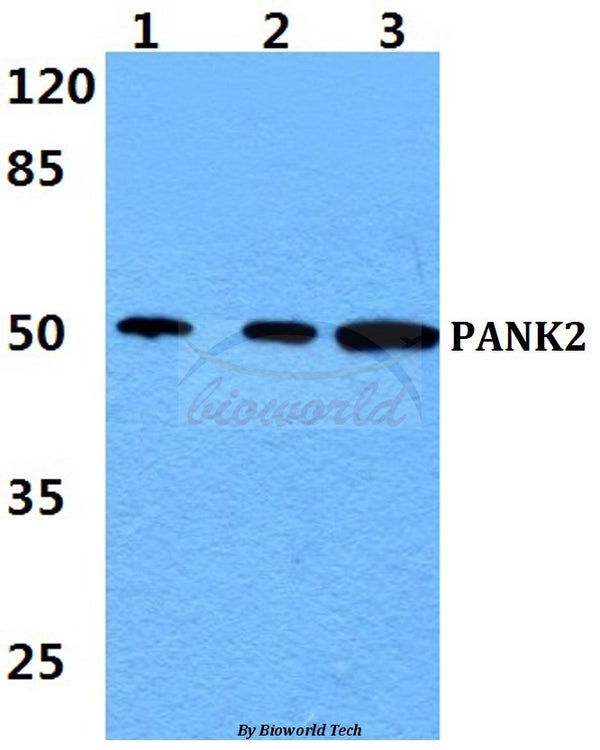 PANK2 polyclonal antibody – Figure 1 of 1