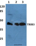Western blot (WB) analysis of TRIB3 polyclonal antibody at 1:500 dilution
Lane1:Hela cell lysate
Lane2:sp2/0 cell lysate
Lane3:PC12 cell lysate