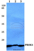 Western blot (WB) analysis of PROK1 polyclonal antibody at 1:500 dilution
Lane1:HEK293T whole cell lysate
Lane2:Raw264.7 whole cell lysate
Lane3:PC12 whole cell lysate