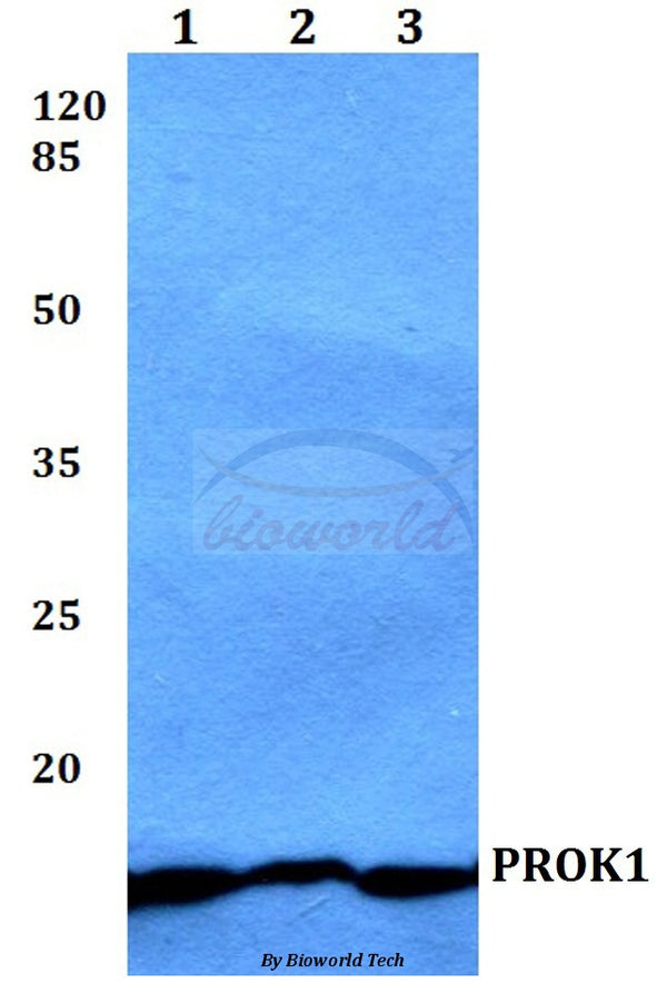 Western blot (WB) analysis of PROK1 polyclonal antibody at 1:500 dilution
Lane1:HEK293T whole cell lysate
Lane2:Raw264.7 whole cell lysate
Lane3:PC12 whole cell lysate