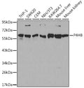 WesternBlot (WB) analysis of P4HB polyclonal antibody